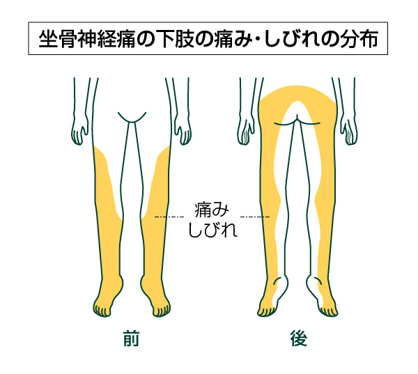 下半身 の しびれ